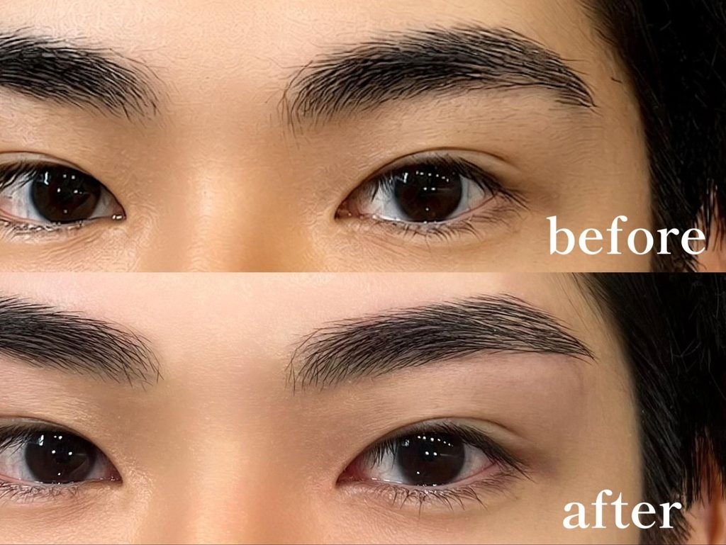 メンズの眉毛施術のビフォーアフター