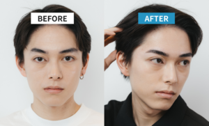メンズアイブロウサロンで施術を受けた男性のビフォーアフター